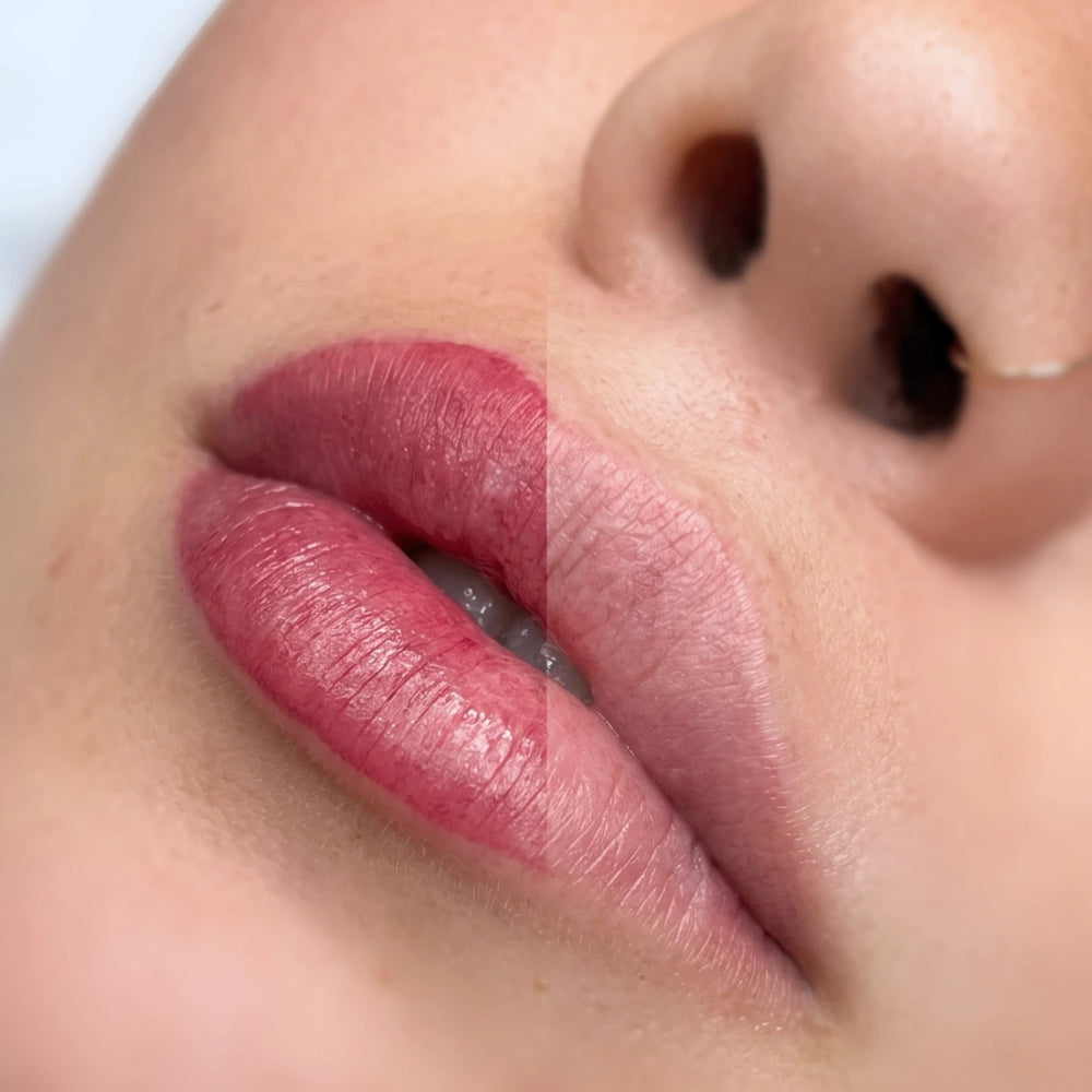 Fresh pigment compared with a healed lip result